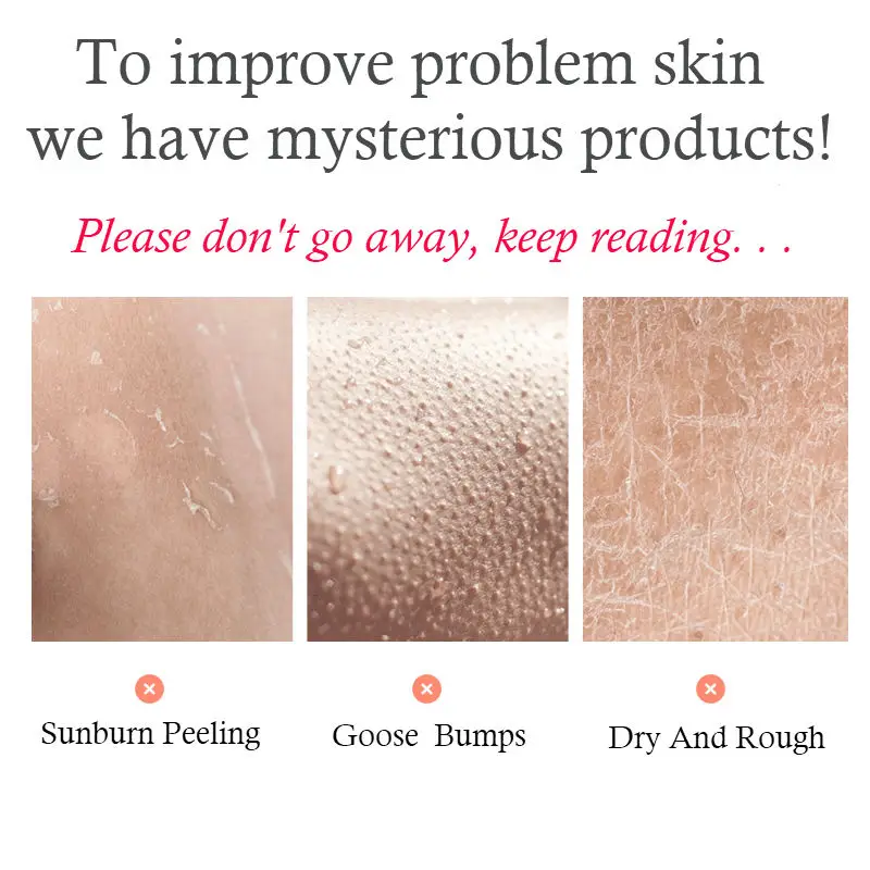 Ceramide отбеливающий крем для тела молочный арбутин увлажняющий лосьон глубокое