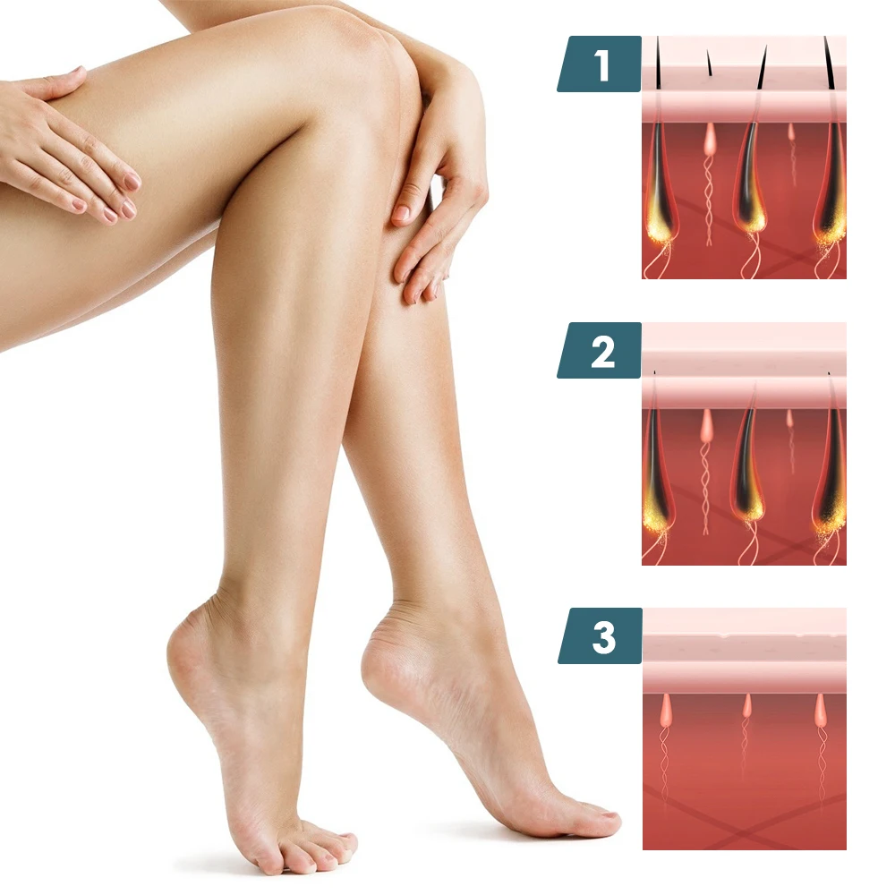 

IPL Hair Removal for Women and Men Permanent Laser Hair Removal 999,900 Flashes Laser Epilator Treatment Whole body Home Use