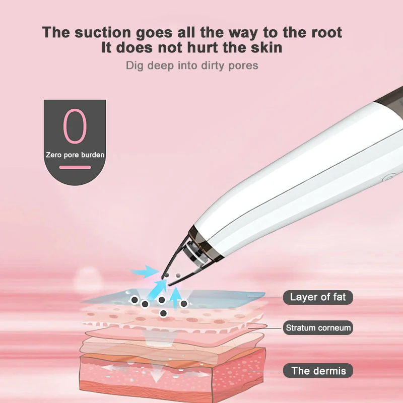 Пылесос для удаления угрей лица акне ПОР очиститель инструменты кожи