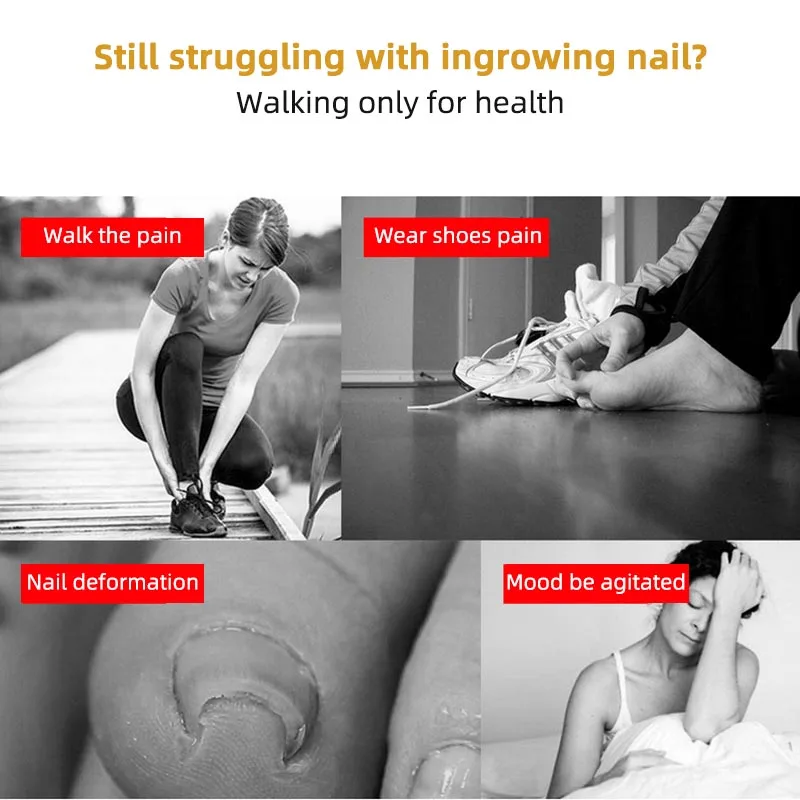 

Stainless Steel Paronychia Corrector Roller Armor Nail Manicure Repair Tool Correction Pliers Cuticle Scissors