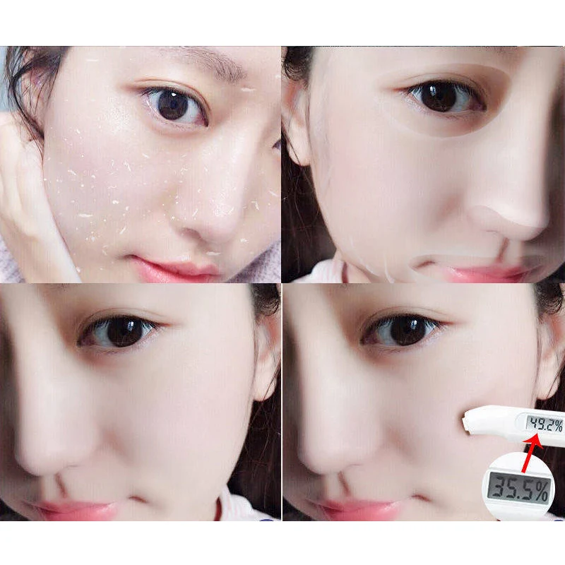 ОТШЕЛУШИВАЮЩИЙ ПИЛИНГ для лица гель глубокой очистки от угрей удаления контроль