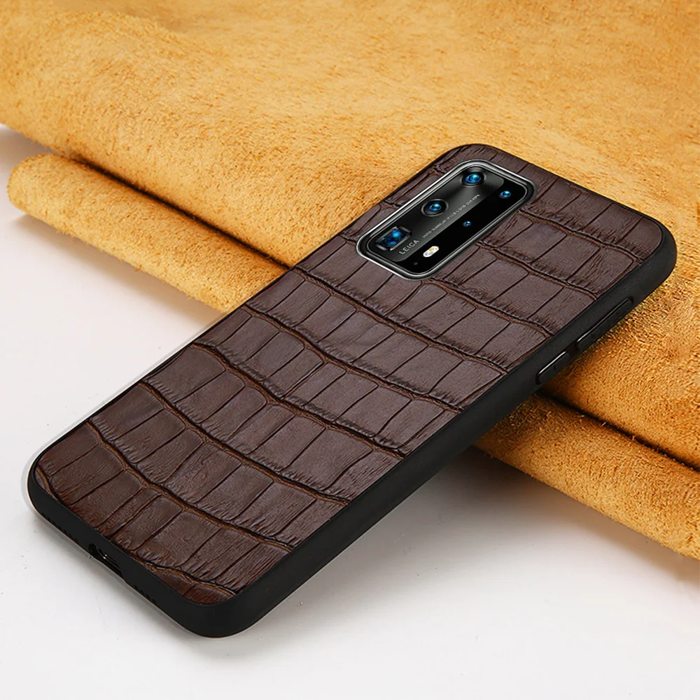 

Genuine Leather Cases for Huawei P40 Pro Plus P40 Lite P30 P20 P10 Mate 20 Y7 Cover For Honor 9X 8X 10i 10 20 Pro Stone Grain