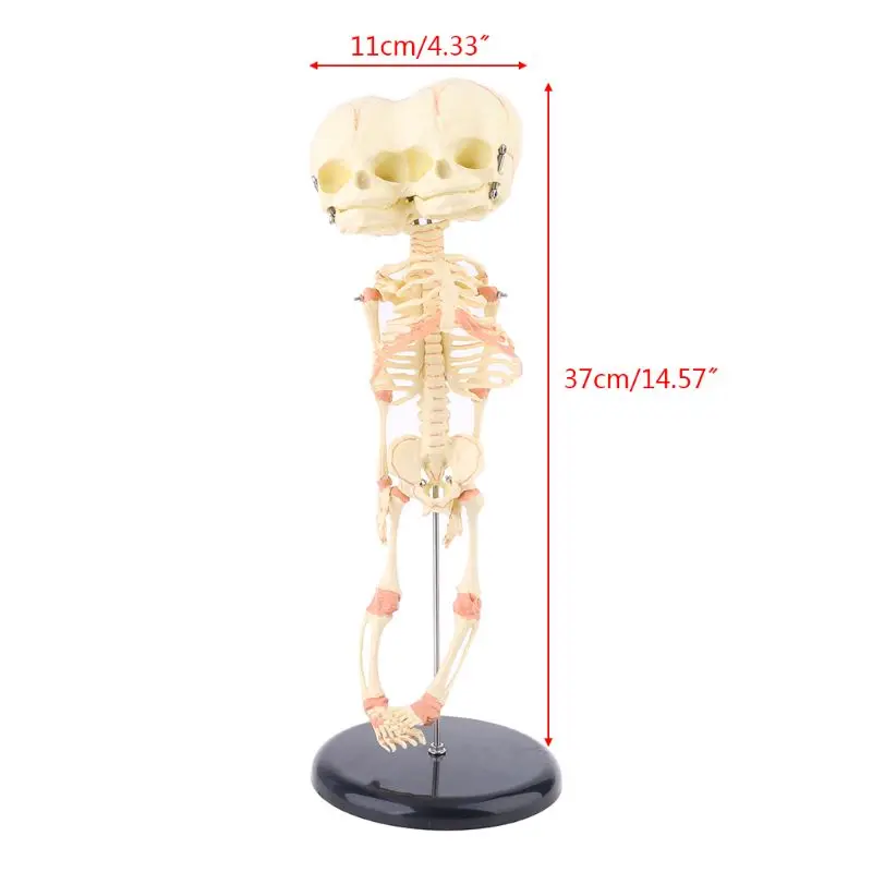 

W3JD Human Baby Deformed Head Skull Research Model Skeleton Anatomical Brain Anatomy Teaching Study Display