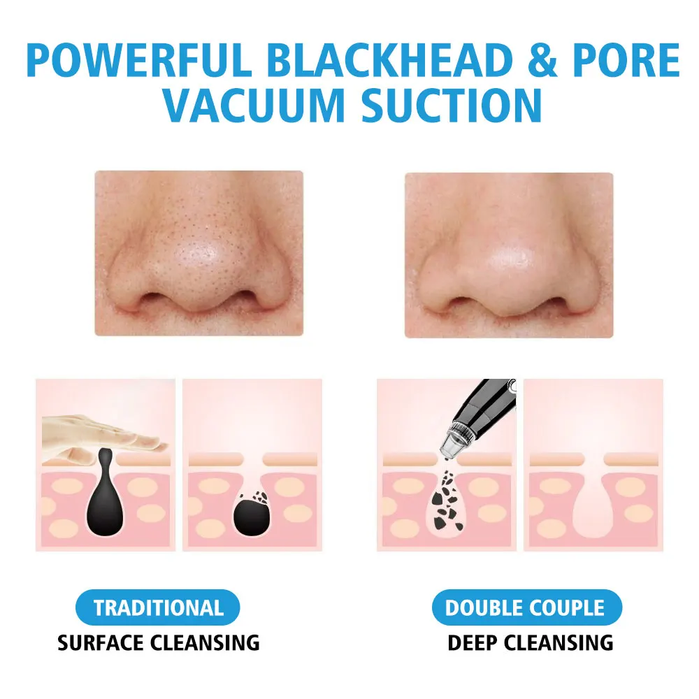 Blackhead Remover Blackhead Vacuum Suction Face Deep Pore Cleansing Acne Pimple Removal Facial SPA Diamond Beauty Skin Care Tool