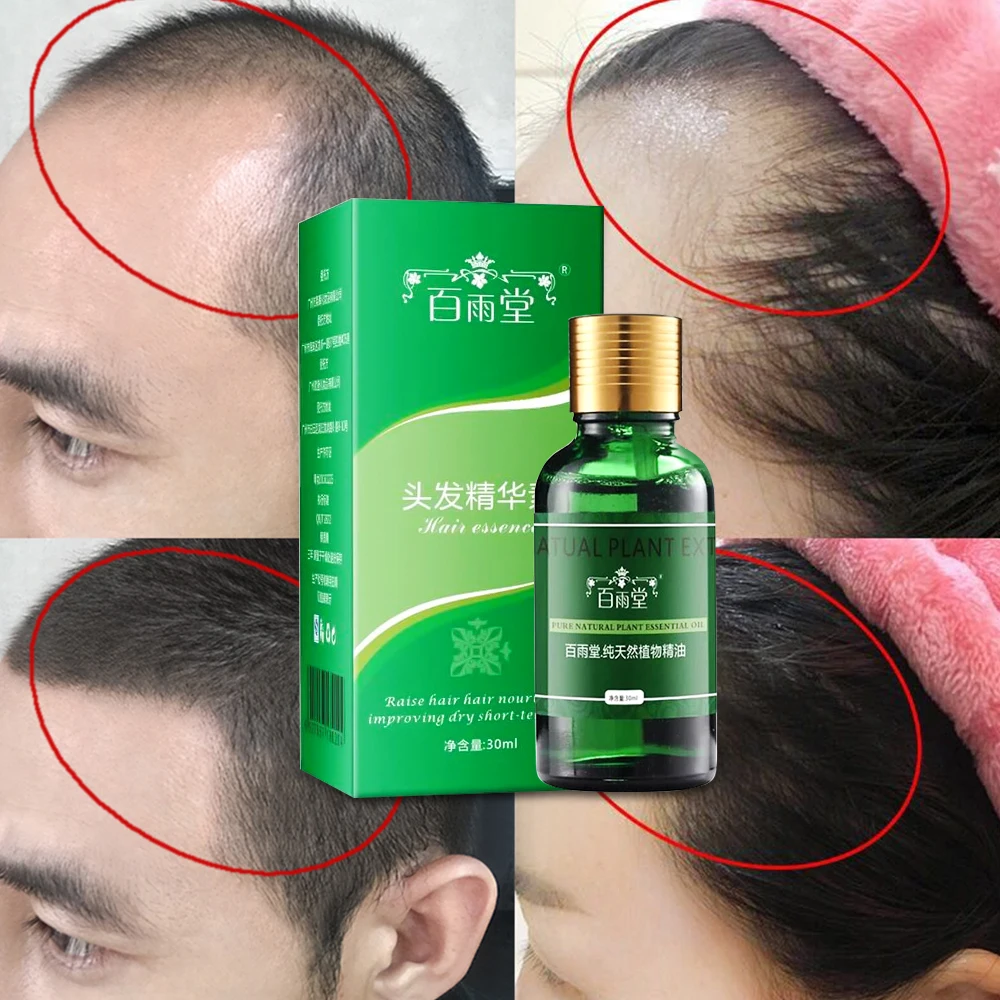 

Hair Care Hair Growth Essential Oils Essence Hair Loss Liquid Health Care Beauty Dense Original Authentic 100% Hair Growth Serum