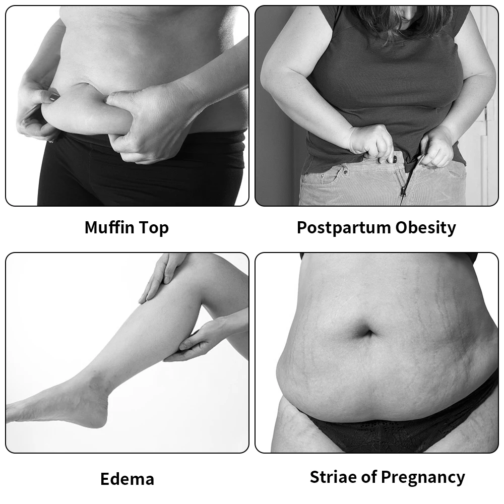 Goede Rf Led Ultrasone Cavitatie Lichaam Afslanken Stimulator Machine Gezicht Lifting Verjonging Vet Brander Verstevigende Apparaat Anti Cellulite