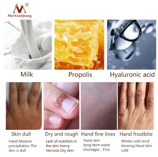 Крем для рук лосьоны сыворотки восстанавливающий питательный крем кожи против