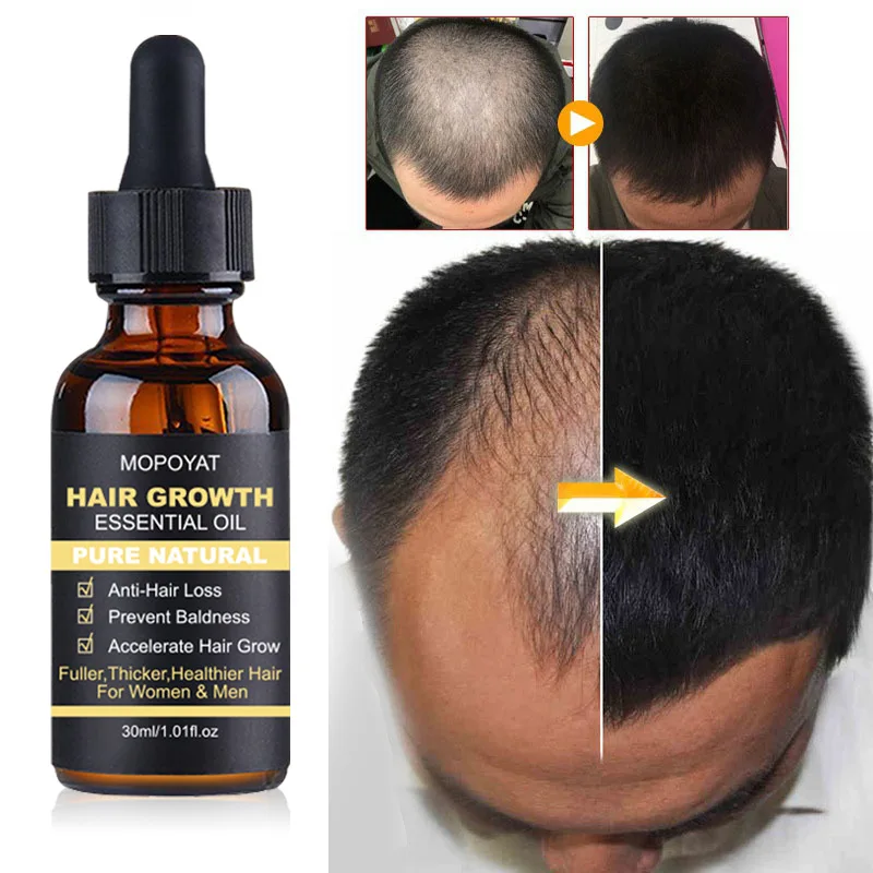 

Fast hair growth intensive regeneration essence oil anti-loss beauty care compact treatment essence hair growth tools hair care