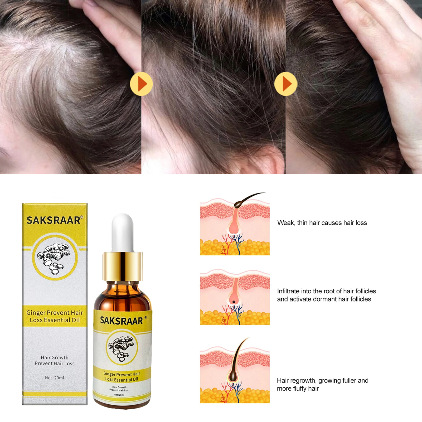 Уход За Волосами Эфирные масла для роста волос экстракт оригинальный