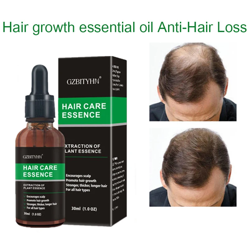 New Hair Growth Essence Oil  Fast Powerful Hair Growth Oil  Products Essential Oil Treatment Preventing Hair Loss Hair Care 30ml