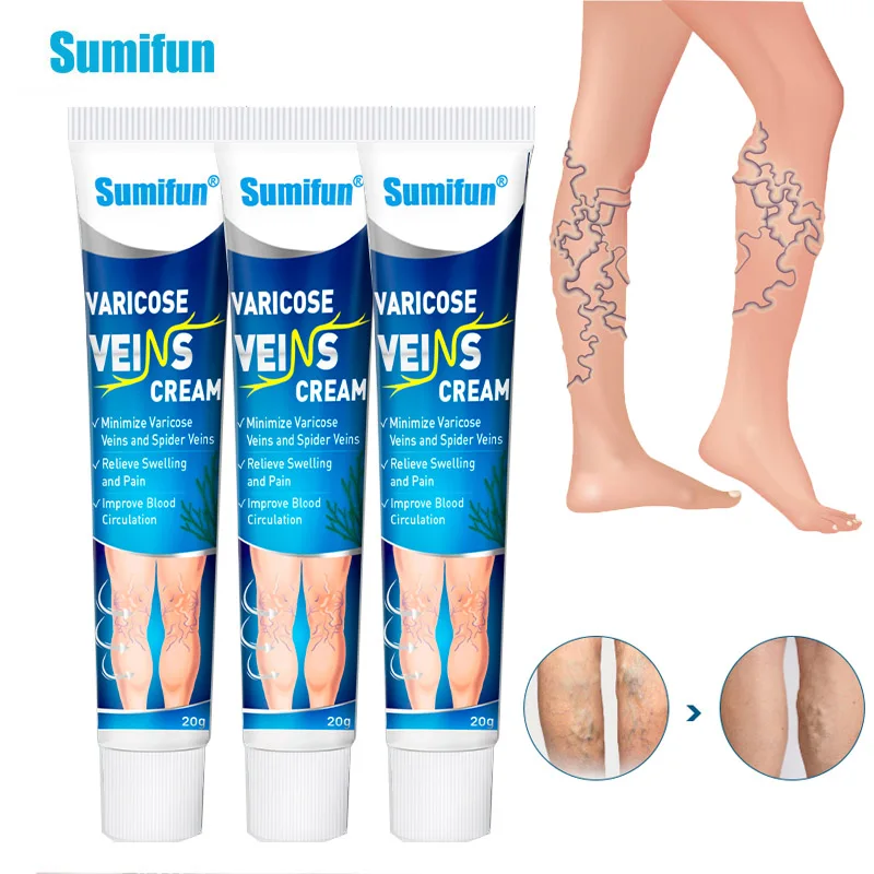 

3Pcs Sumifun New Varicose Veins Treatment Ointmnet Vasculitis Phlebitis Spider Pain Relief Cream Anti-Swelling Medical Plaster