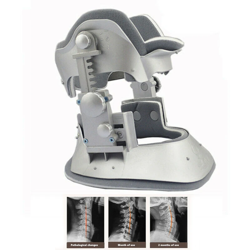 

Schubert Chubert Cervical Neck Tractor Traction Device Orthosis Braces Neck Brace Collar Household Pain Relief