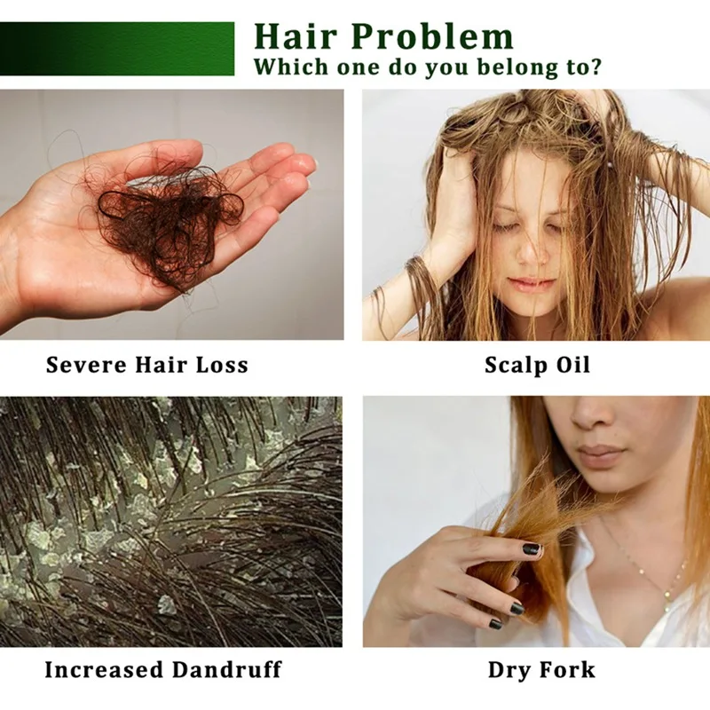 20 мл масло для роста волос рост с эфирным маслом вылечит вас от облысения