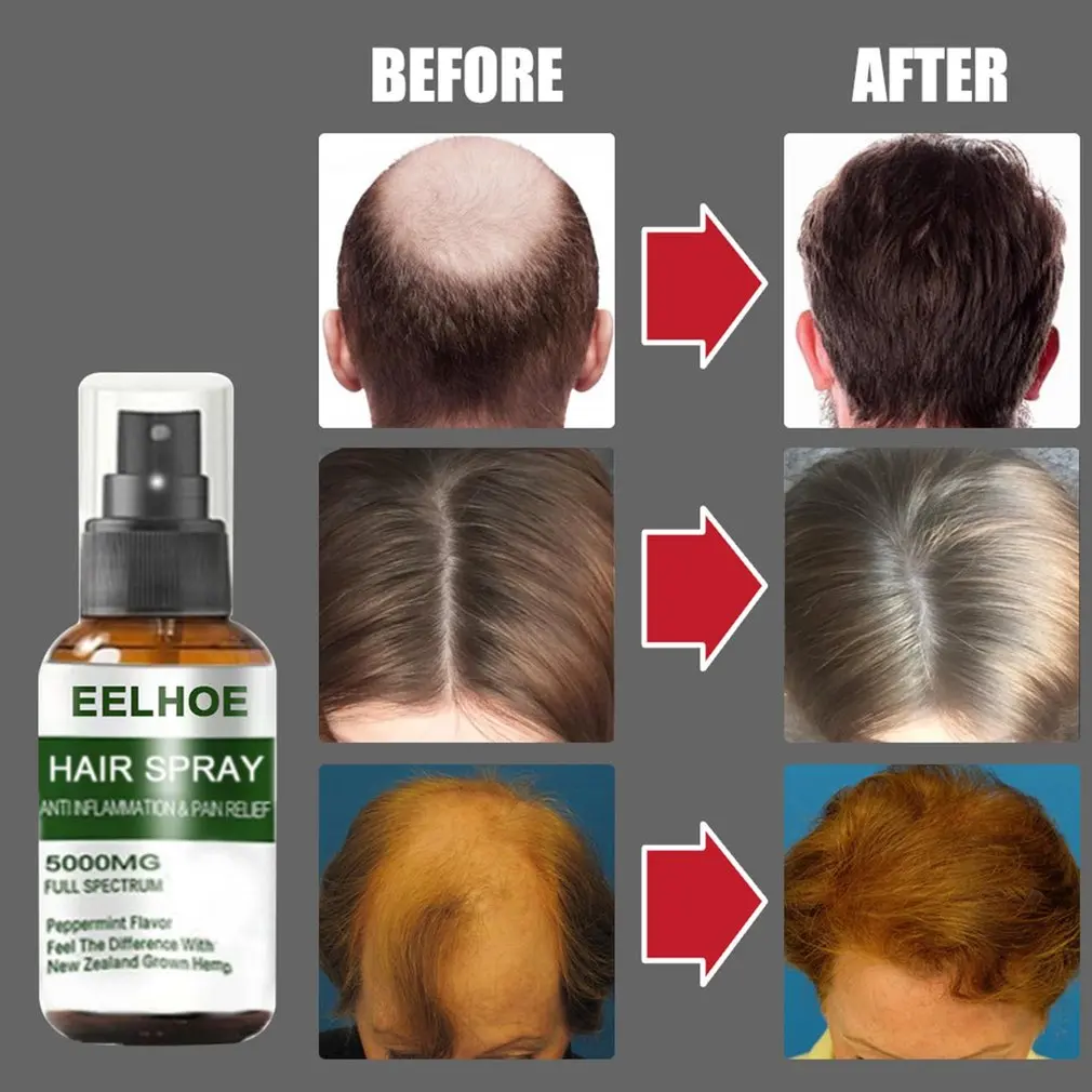 

New 30ml Hair Growth Serum Hair Care Hair Serum Fast Hair Growth Hair Spray Anti Hair Loss Natural Herbal Essence