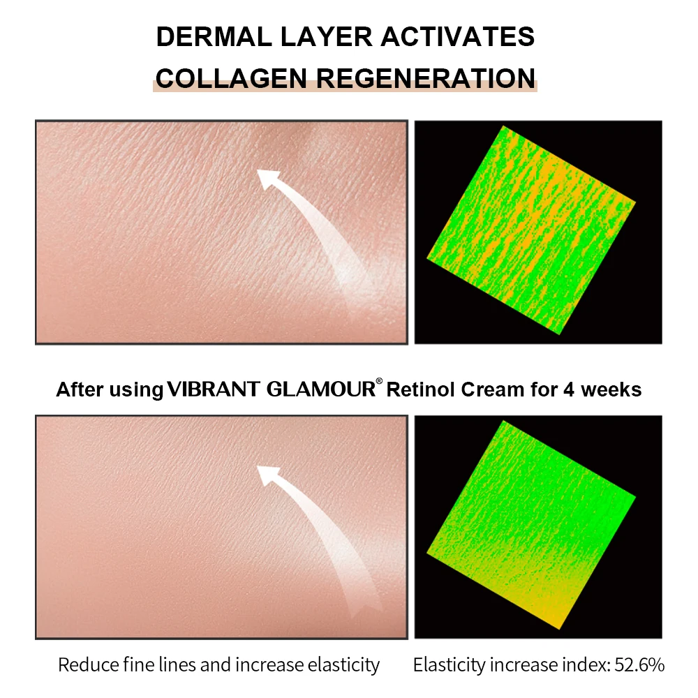 

Retinol Moisturizing Eye Cream Collagen Anti Age Ojeras Mujer Wallen Verwijderen Contorno De Ojos Antiarrugas Olheiras Clareador