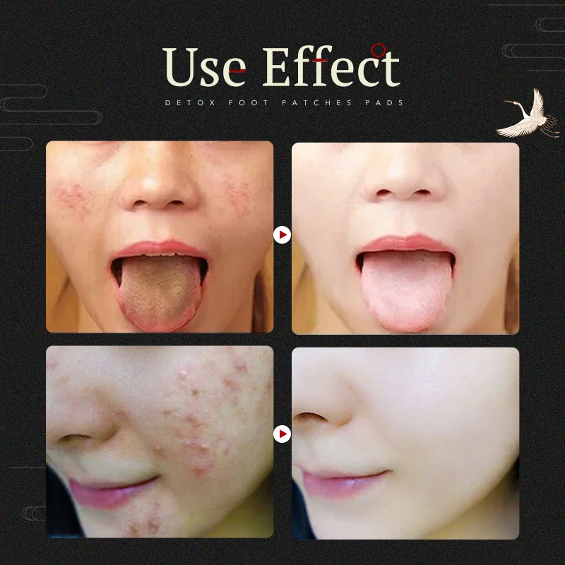 Детокс Патчи для ног 10 шт детоксикация токсинов облегчение боли эффективное