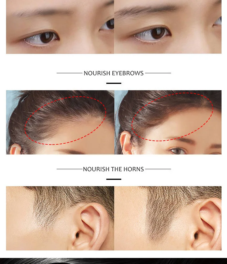 * Эссенция имбирного масла для роста волос средство ухода за кожей головы 30 мл -