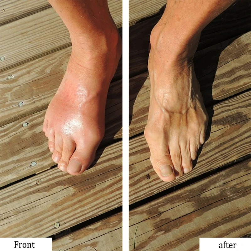 

Ginger Foot Pads Herbal Ginger Patch, Foot Patches Relieve Stress Improve Sleep C1FF