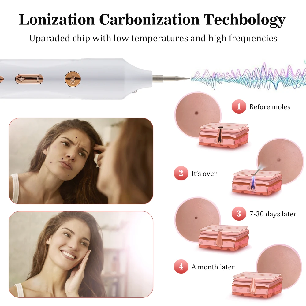 Лазерная ручка для удаления родинок плазменная с ЖК-дисплеем 9 уровней веснушек