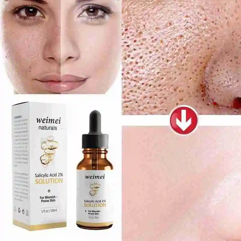 

Naturals Salicylic Acid 2% Solution+for Blemish-Prone Skin Brighten Skin Tone Hydrating Shrink Pore Exfoliating Essence