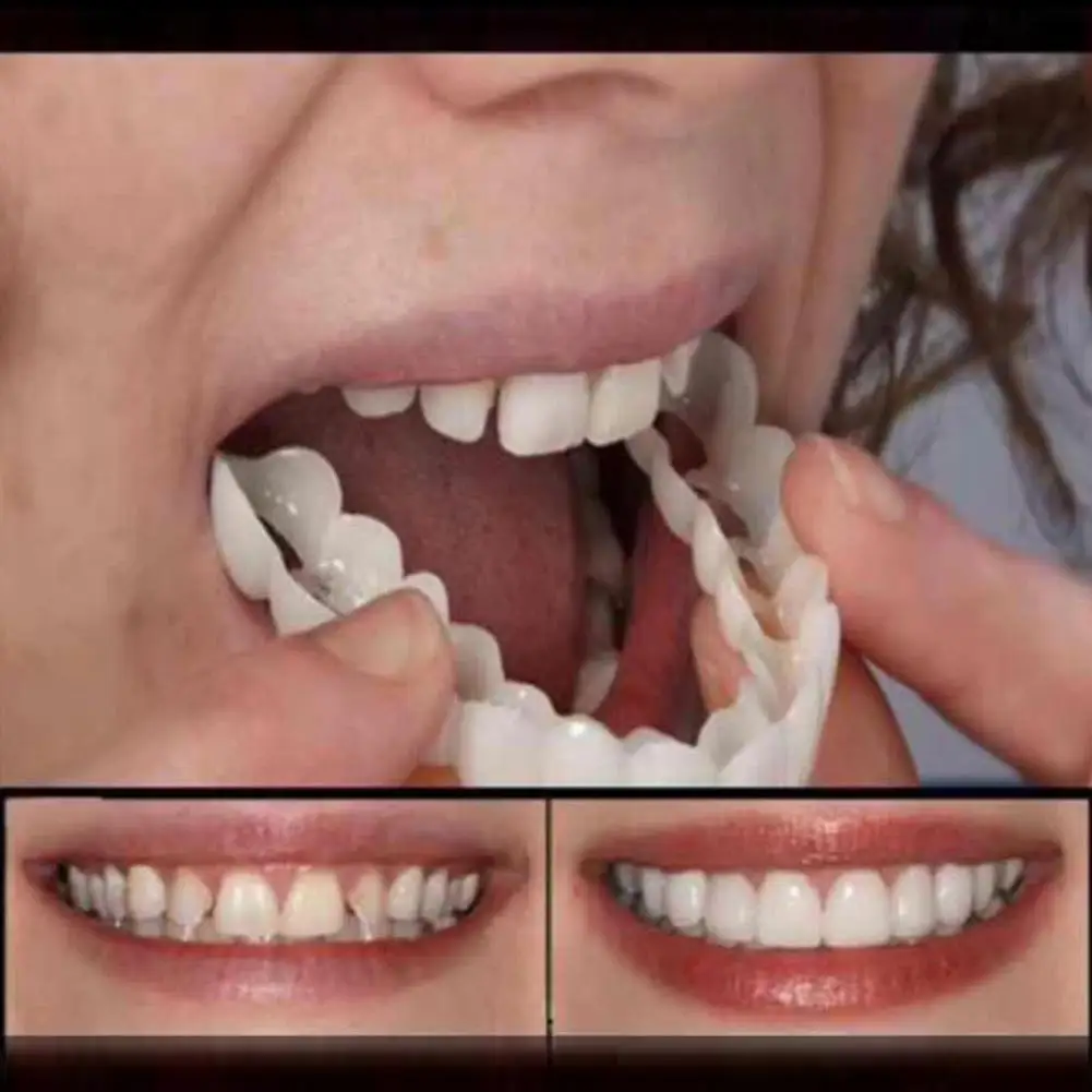 Зубной ортодонтический брекет многоразовые имитация верхний/нижний зубной