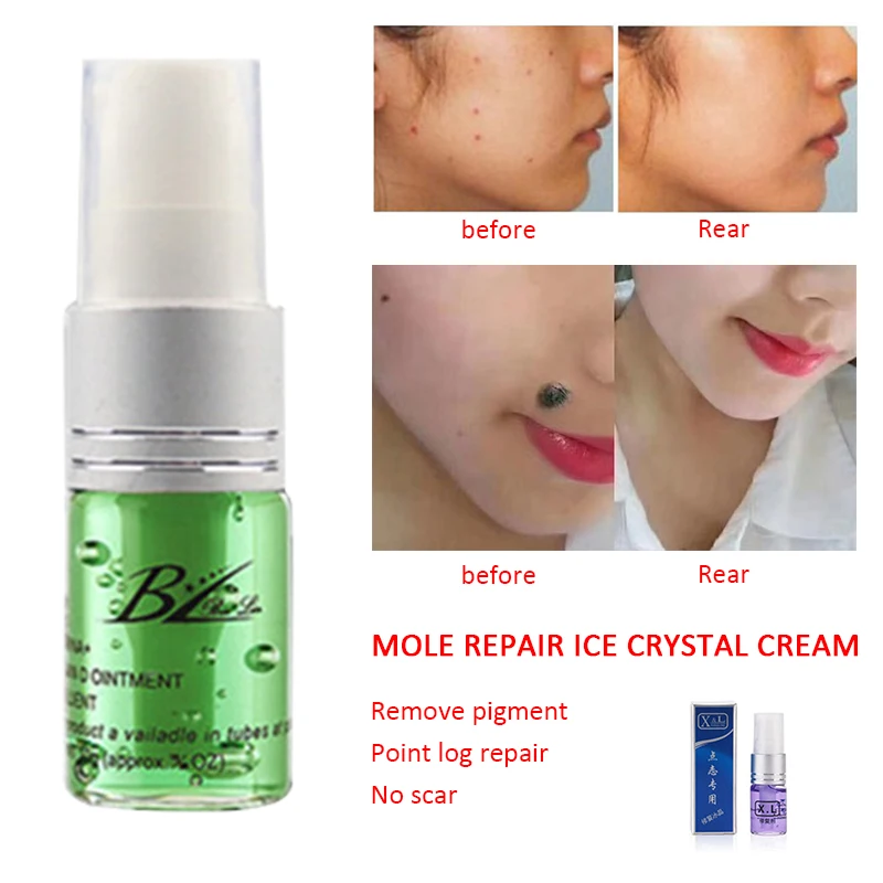 Professional Mole Removal Cream Facial Freckle Wart Tag Face Care Repair Solution Painless TSLM2 |