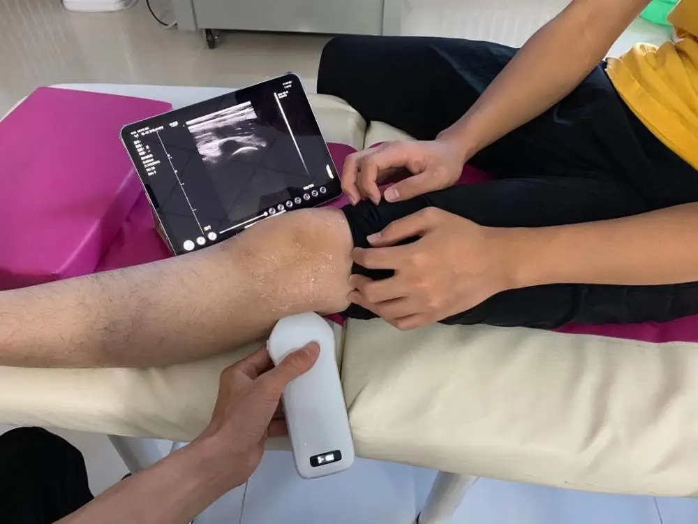 Рисунок 6 - Многоэлементный color192 выпуклый/линейный/Высокочастотный/микро