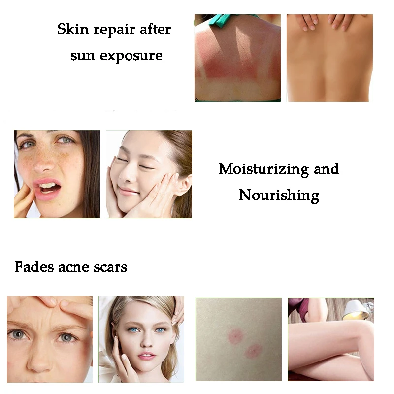 60 мл успокаивающий гель для лица кожи с алоэ вера уход удаление акне Увлажняющий