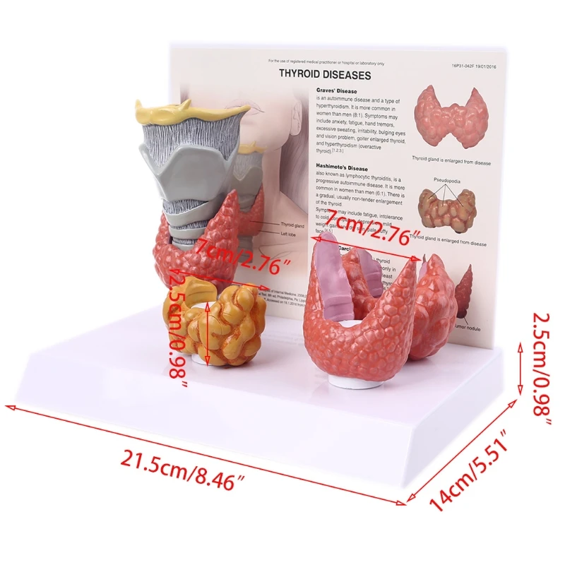 

Human Anatomical Thyroid Gland Model Pathology Anatomy Digestive System Study Teaching Tool H9EB