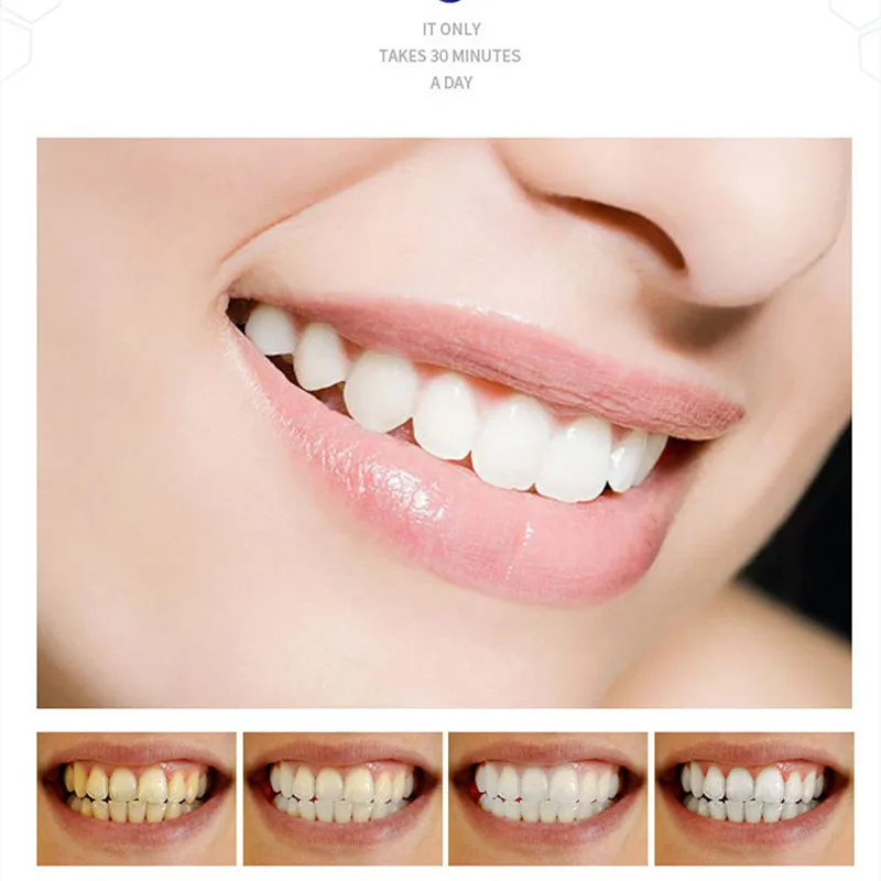 

7Pair/14PCS Dental Oral Hygiene Teeth Whitening Stripes Dental Whitening Elastic Strip