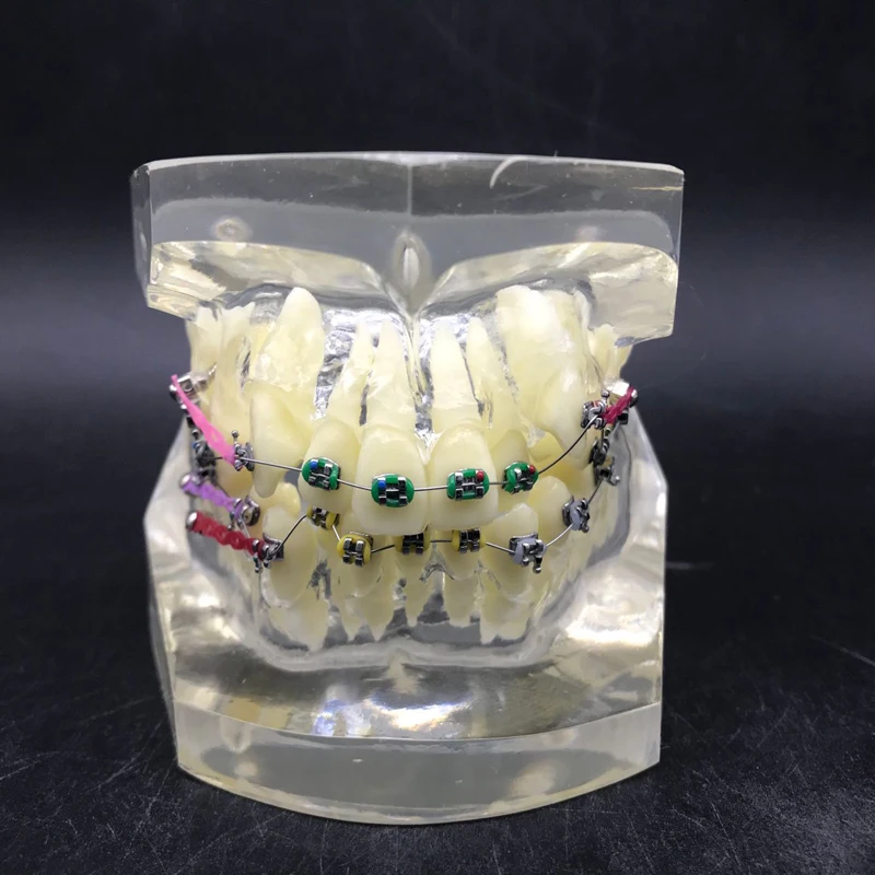 Dental Tooth Model with Colorful  brackets M3005/ Teaching demonstration Teeth model/Anchor nail traction correction tooth model