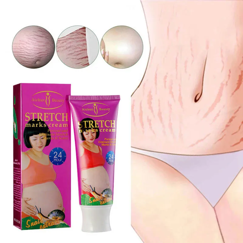 Средство для удаления растяжек крем кожи свободной линии крема тела беременных
