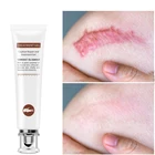 Средство для удаления растяжек LAIKOU, уход за кожей, крем для шрамов от растяжек, лечение шрамов, Восстанавливающий уход за кожей, крем для тела, био-масло