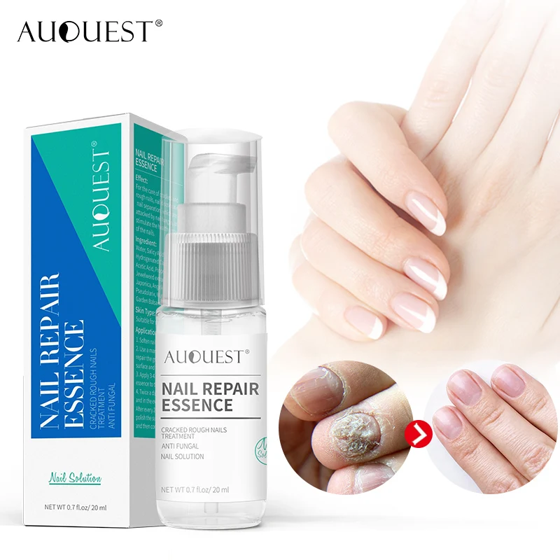 

Nail Fungal Treatment Feet Care Essence Spray Nail Foot Whitening Toe Nail Fungus Removal Anti Infection Onychomycosis Feet Care