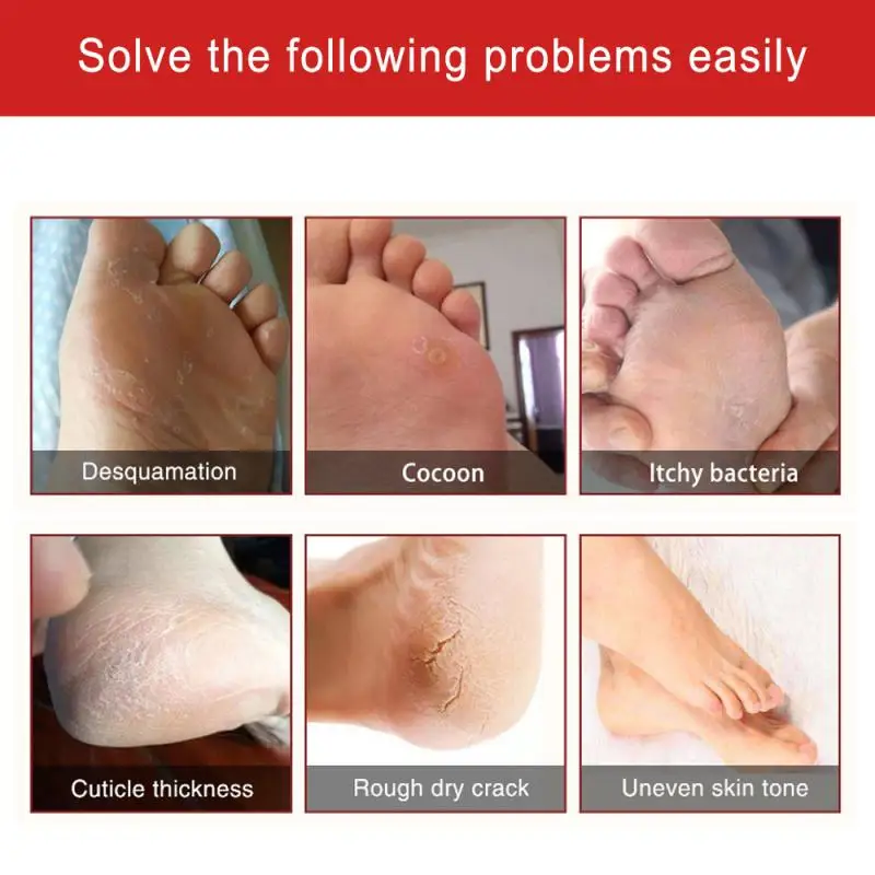 На основе конского жира крем для пяток ремонта против трещин отбеливающий ног