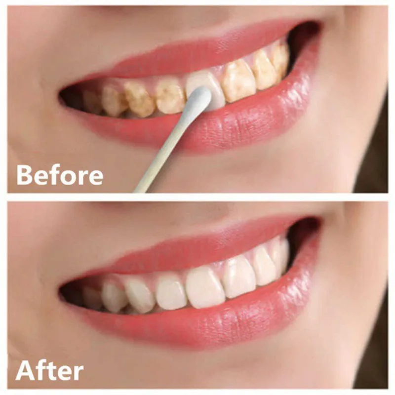 Новая китайская медицина волшебный натуральный жемчужный порошок для зубов