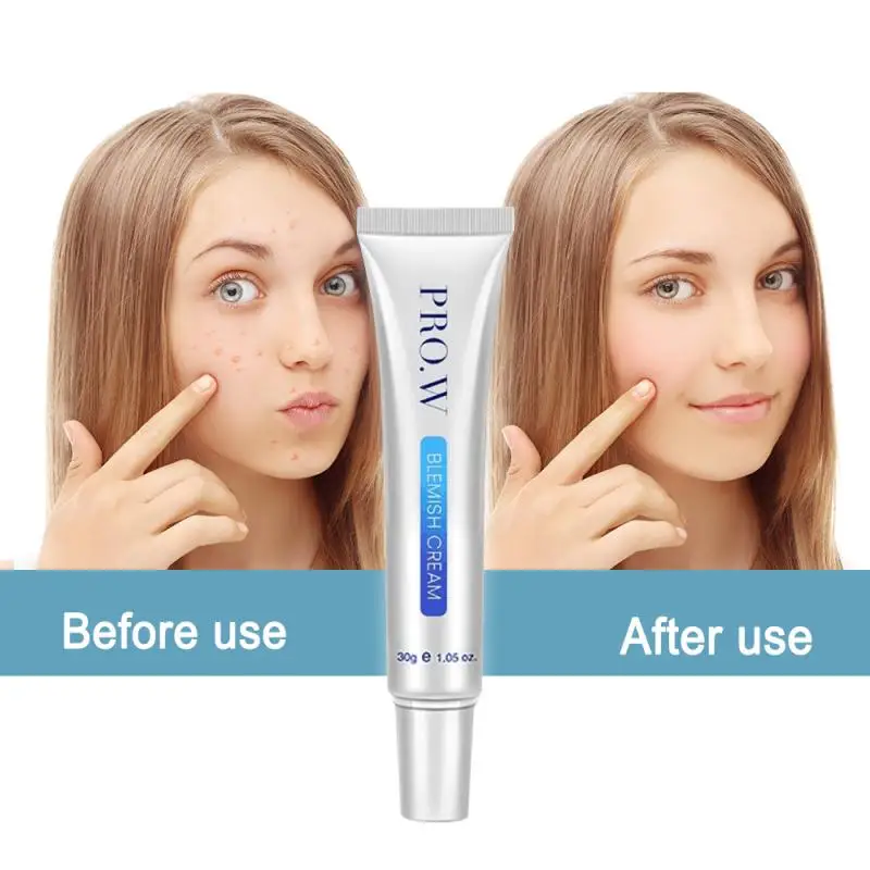 Дневной крем против акне водно Масляный для баланса увлажняющий удаления пятен