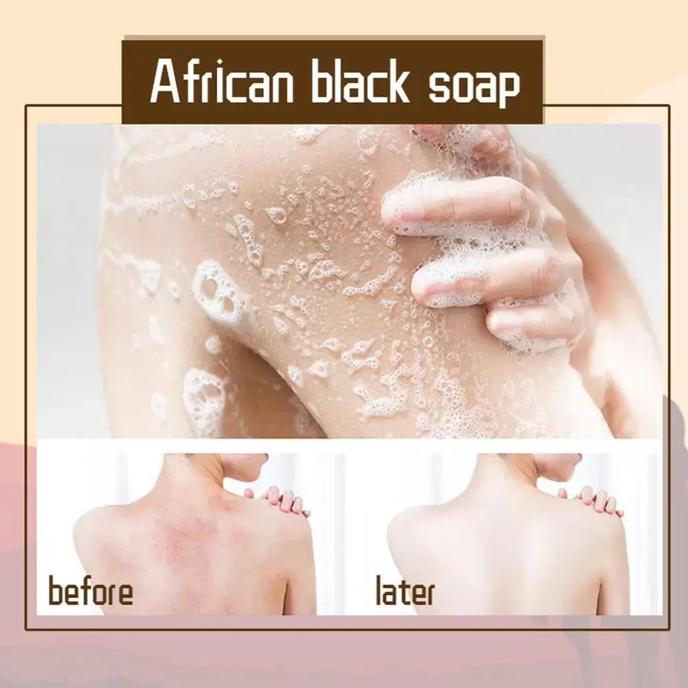 

110g natural 100% african beauty black soap anti taches rebels beauty bath clean body treatment soap skin care supplies