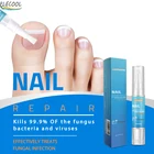 Сыворотка для лечения грибка ногтей ELECOOL, эссенция для восстановления ногтей, уход за онихомикозом, паронихией, противогрибковая инфекция ногтей, травяной грибок