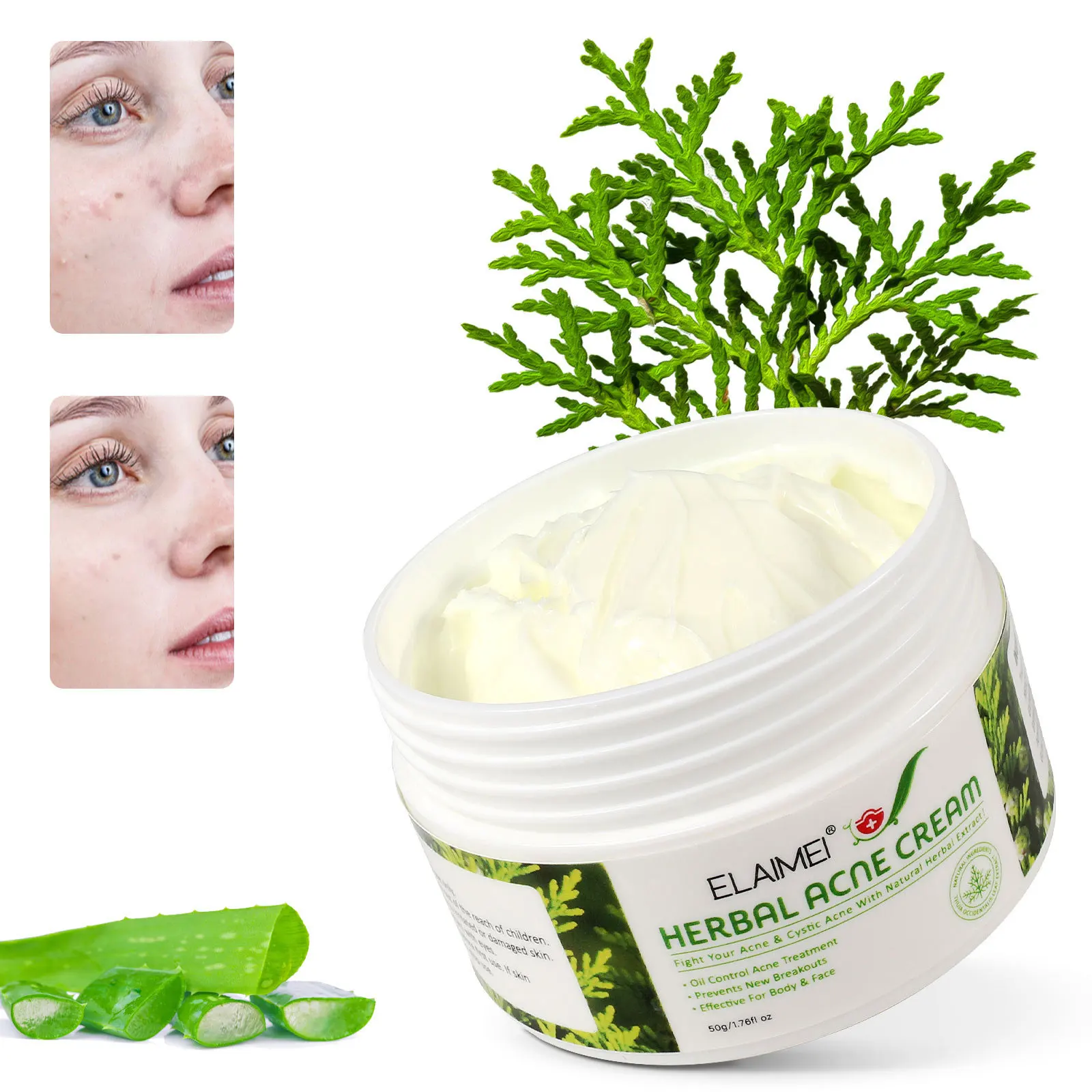 

ELAIMEI Herbal Acne Cream Mild Anti Acne Refreshing Soothing Face Acne Removal Whitening Moisturizing Skin Care Acne Cream