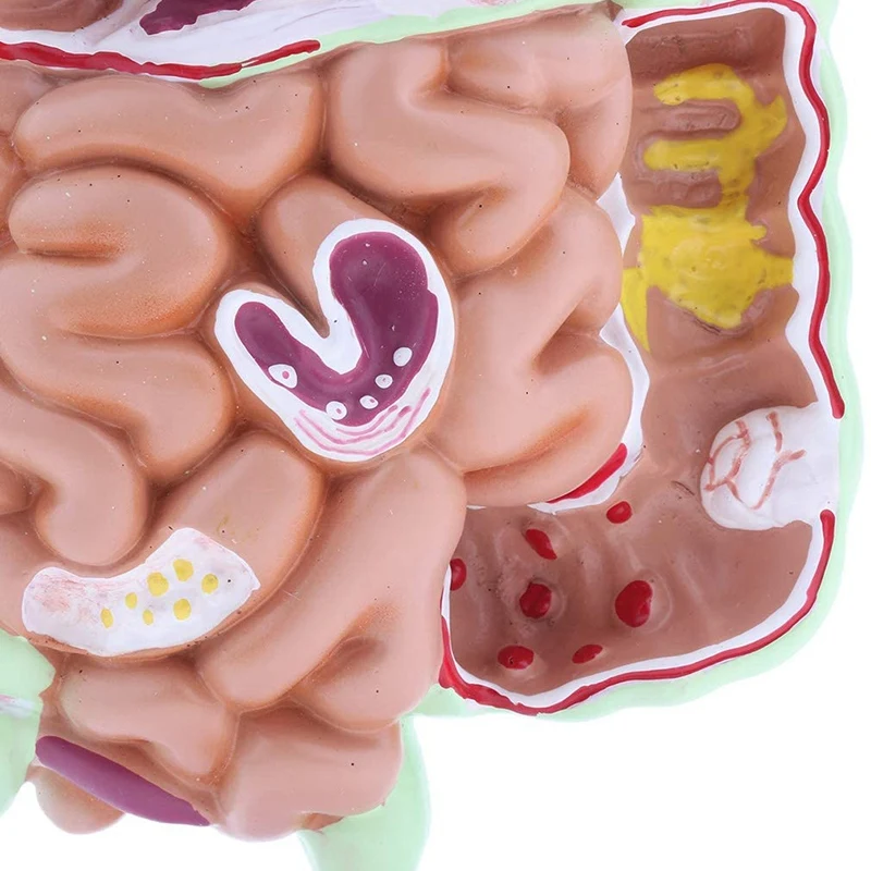 

Life Size Human Digestive System Model Stomach Anatomy Large Intestine Cecum Rectum Duodenum Human Visceral Structure