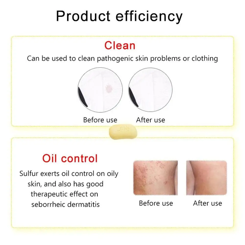 

Shanghai Sulfur Soap Acne Treatment Blackhead Remover Whitening Cleanser Oil-control Sabonete Chinese Traditional Skin Care