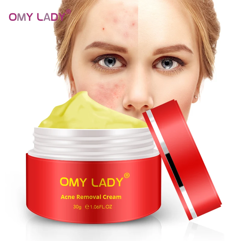 OMY LADY мощный мульти эффект экстракта крем устраняет морщины удаление акне шрамов лечение акне Антивозрастной уход за лицом гель