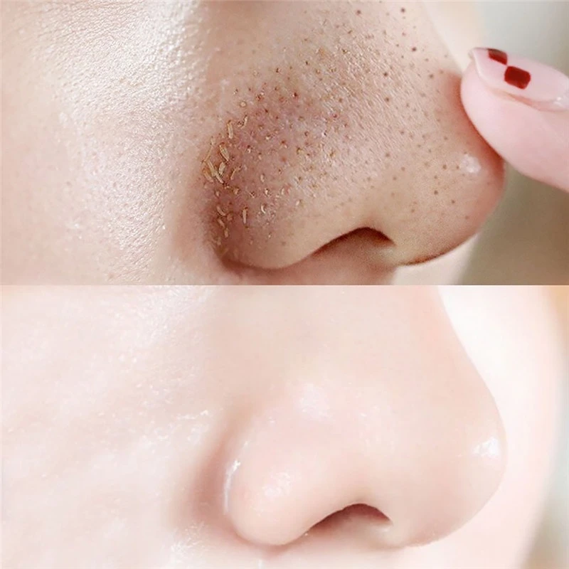 

10PCS Bamboo Charcoal Blackhead Remover Deep Nose Pore Cleansing Strip Nose Sticker Pig Nose Mask Charcoal Pore Strip Deep Clean