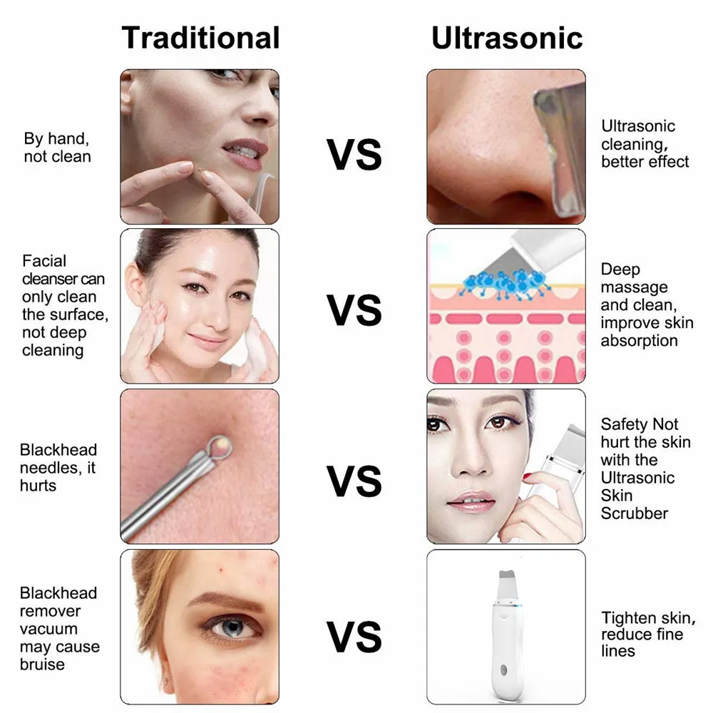 Скребок для кожи лица Электрический нежный удаления черных точек Ультразвуковой