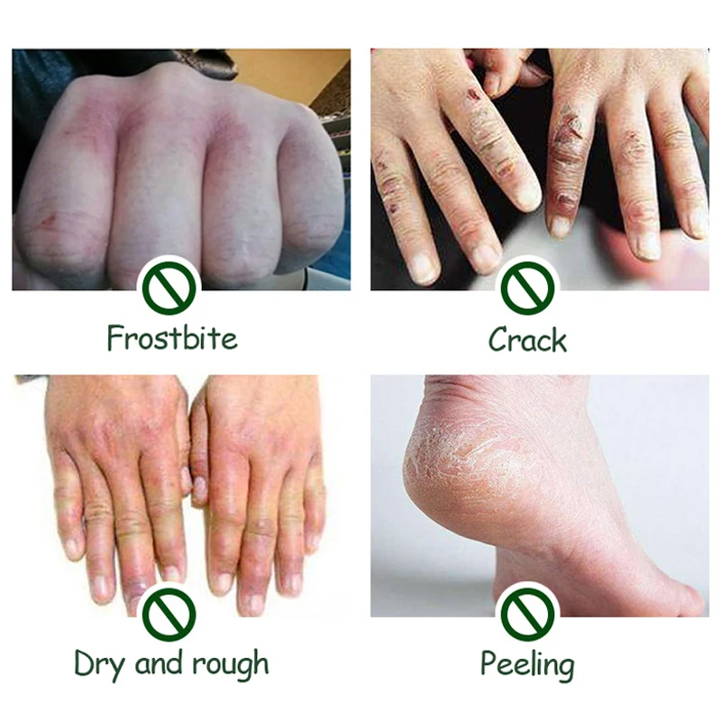 Конское масло крем для рук пятка ног набор ремонта анти сухая трещины