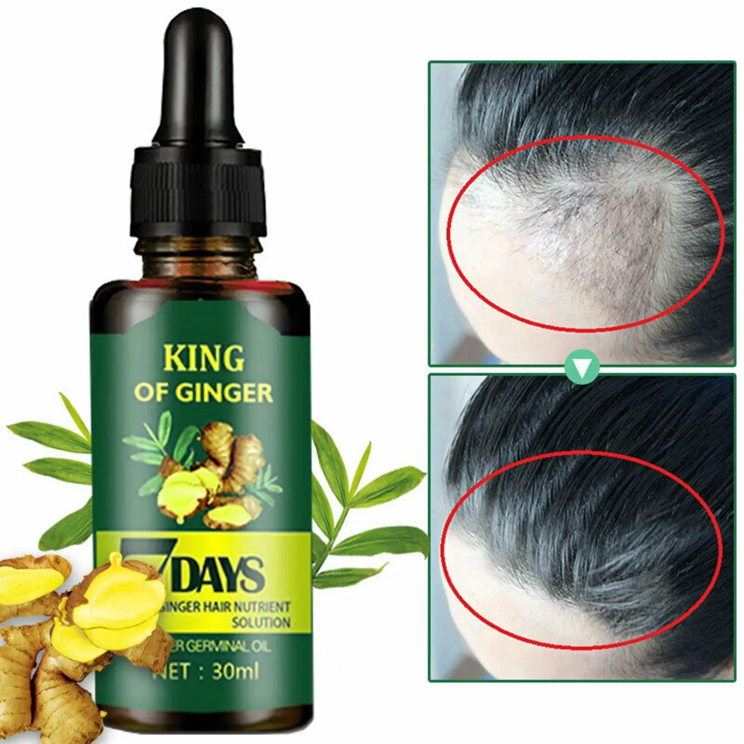 

Anti Hair Loss Natural Extract Ginger Hair Growth Serum Germinal Oil Pilatory Hair Care Regrowth Unisex Fast Effective