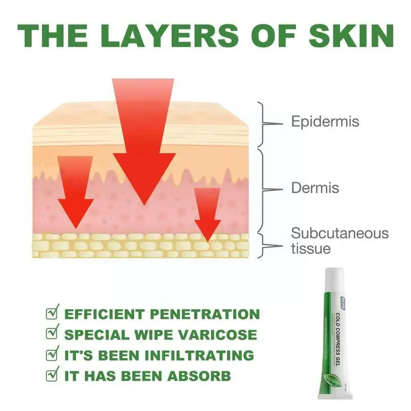 Гель для варикозного расширения вен и лечебная ручка эффективное облегчение