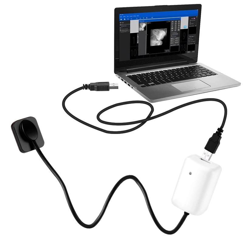 Рентгеновский рентгеновский Датчик Rvg с цифровой системой прямого изображения |