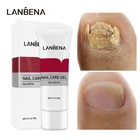 Средство для лечения Ногтей от грибков LANBENA, гель для восстановления ногтей, удаление онихомикоза, противоинфекционное удаление грибка ногтей, эффективное смягчение ухода за ногтями